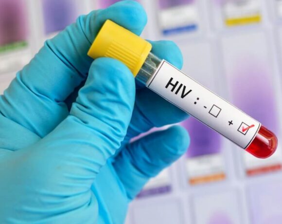 HIV