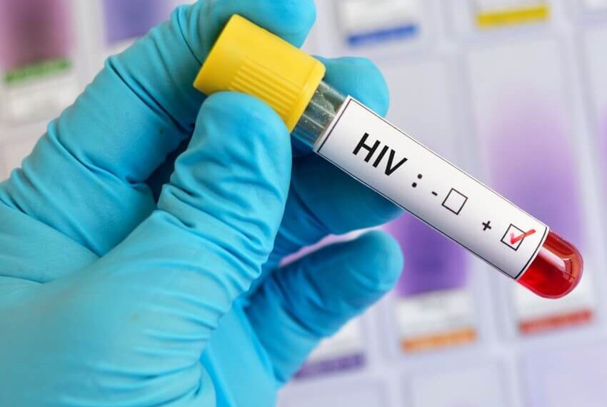 HIV