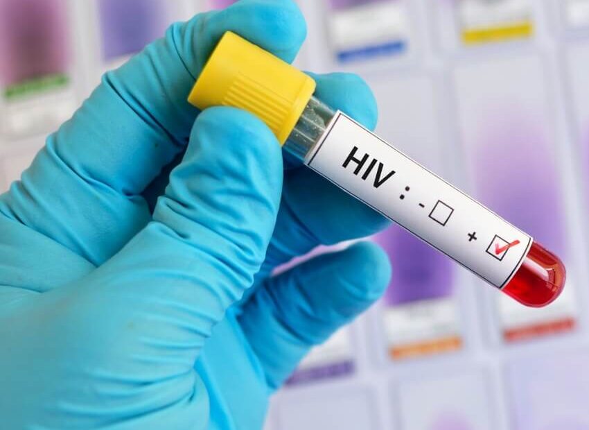 HIV