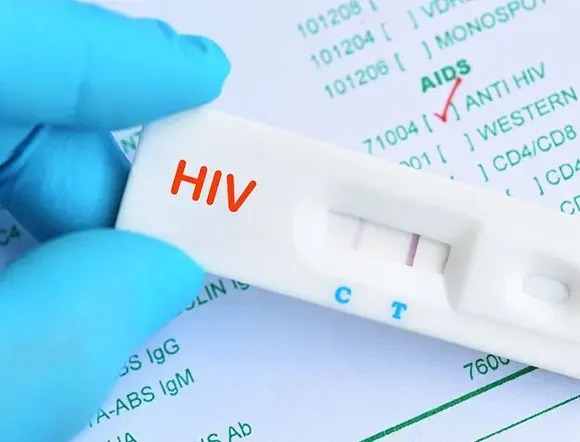 HIV