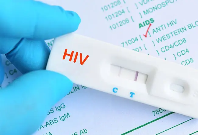 HIV